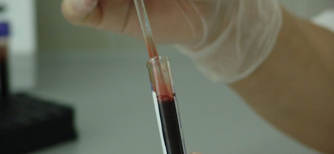 Campione di sangue in provetta, emocromo e ferritina — BioLab Capurso