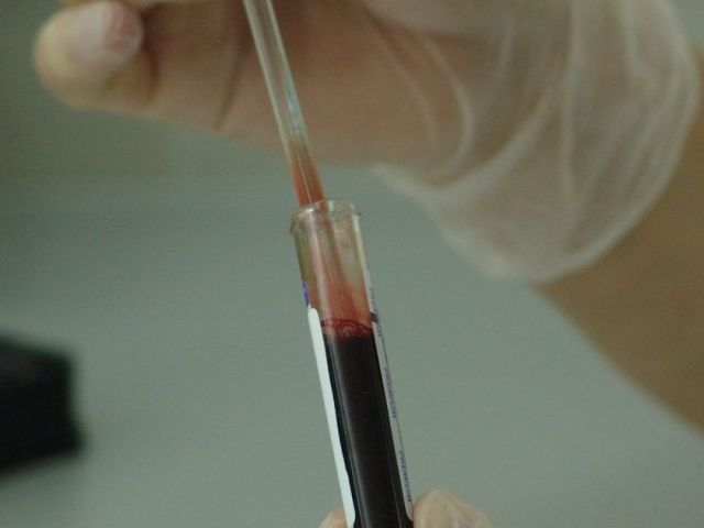 Campione di sangue in provetta, emocromo e ferritina — BioLab Capurso