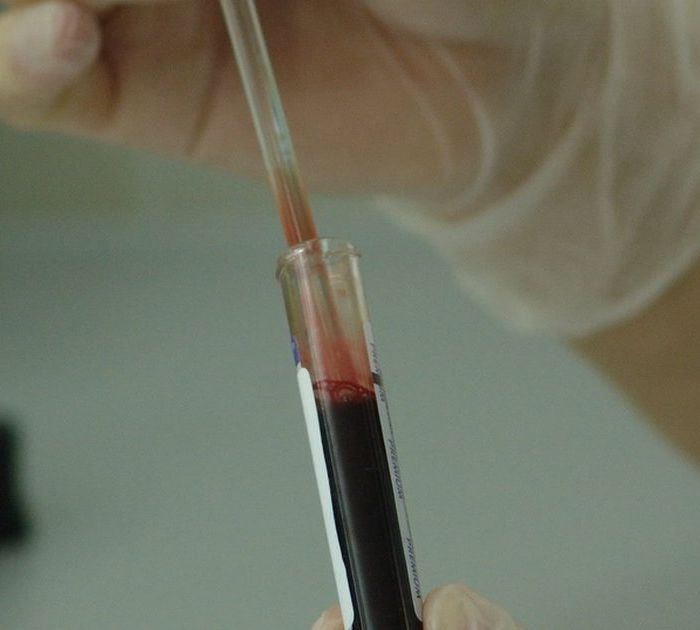 Campione di sangue in provetta, emocromo e ferritina — BioLab Capurso