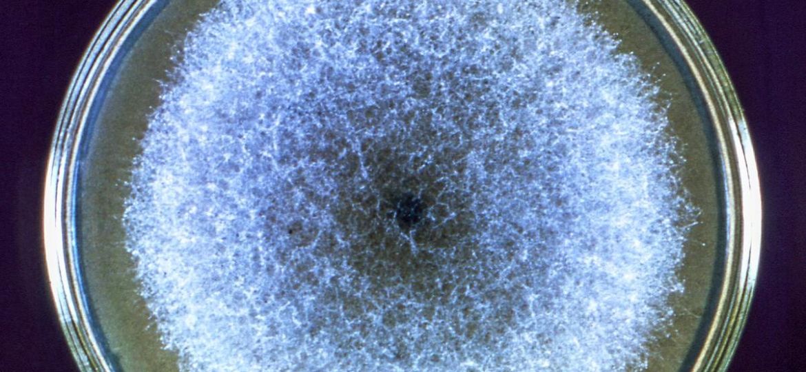 Coltura in piastra di Petri, esami microbiologici — BioLab Capurso