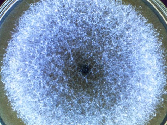 Coltura in piastra di Petri, esami microbiologici — BioLab Capurso