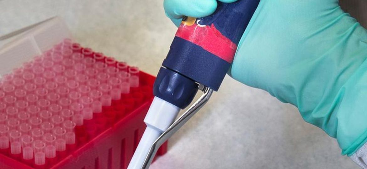Pipetta e provette in laboratorio, referti in giornata — BioLab Capurso