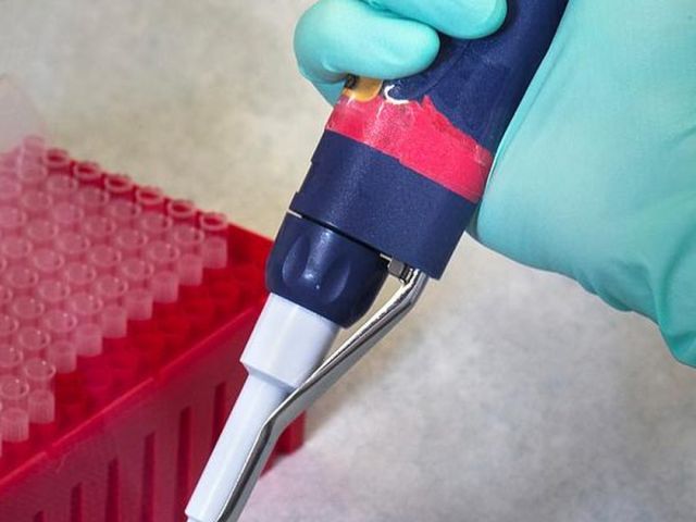 Pipetta e provette in laboratorio, referti in giornata — BioLab Capurso