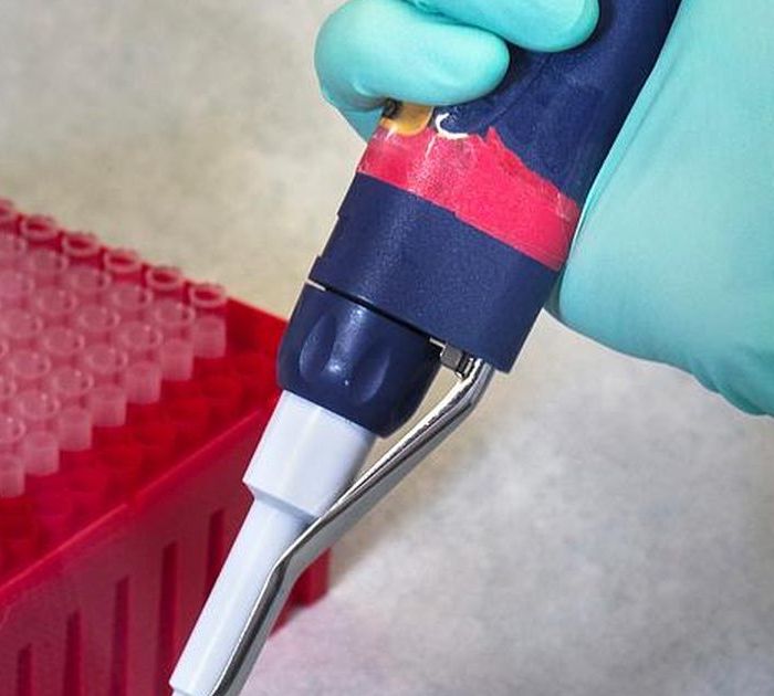 Pipetta e provette in laboratorio, referti in giornata — BioLab Capurso