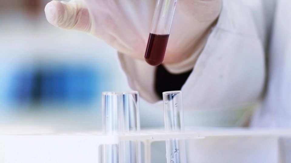 Operatore di laboratorio esegue un dosaggio su campione ematico