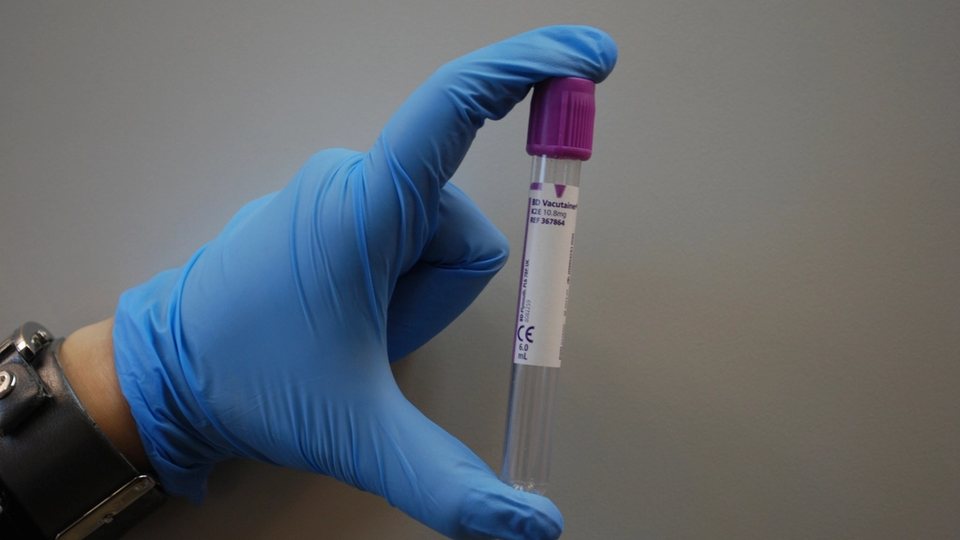 Provetta per prelievo ematico tenuta da un operatore di laboratorio con guanti
